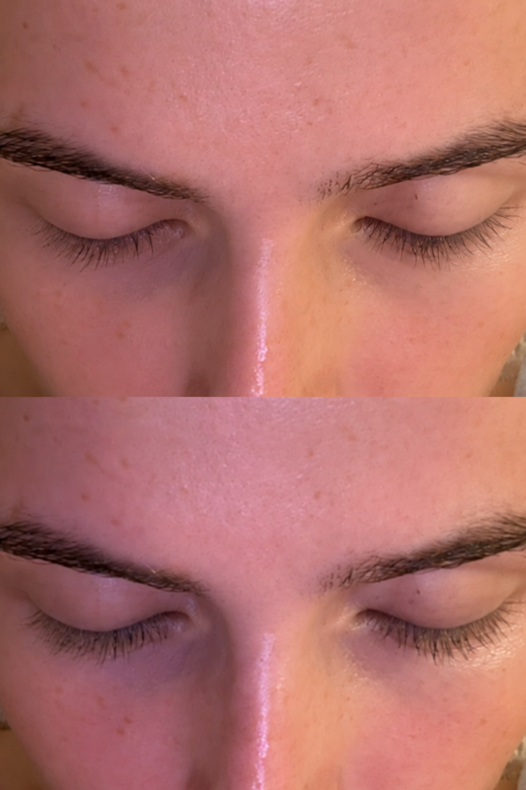Activating Peptide Eyelash Serum – Prostaglandin-Free